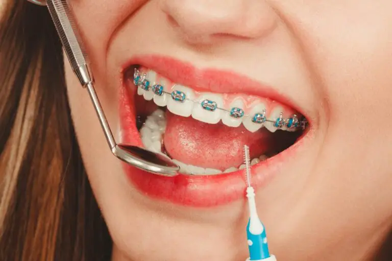 Is Tooth Gem Glue Safe? Everything You Need to Know