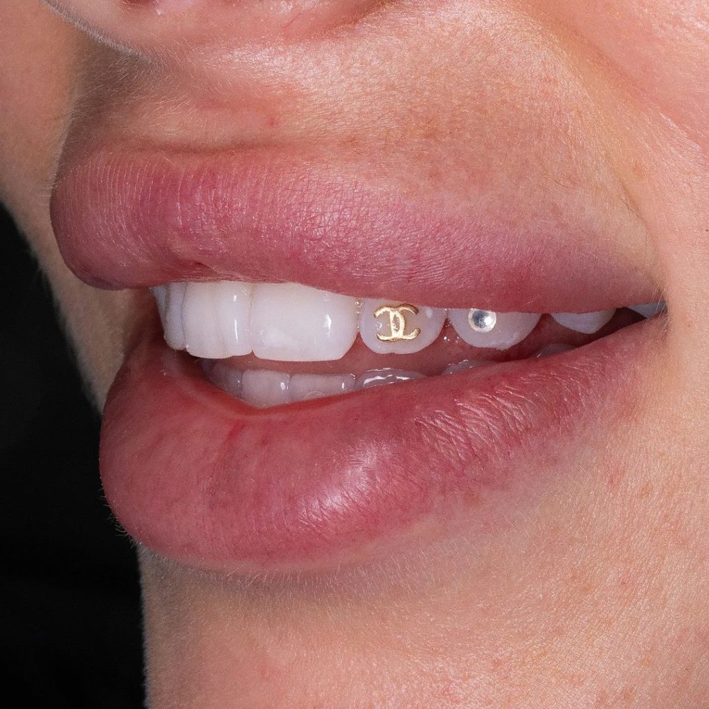 Tooth Gems Are All Over Social—But Are They Actually Safe For Your