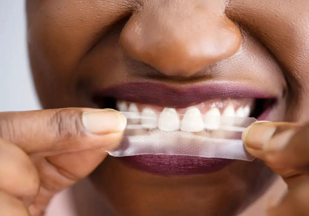 Is Tooth Gem Glue Safe? Everything You Need to Know